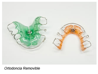 Ortodoncia Removible